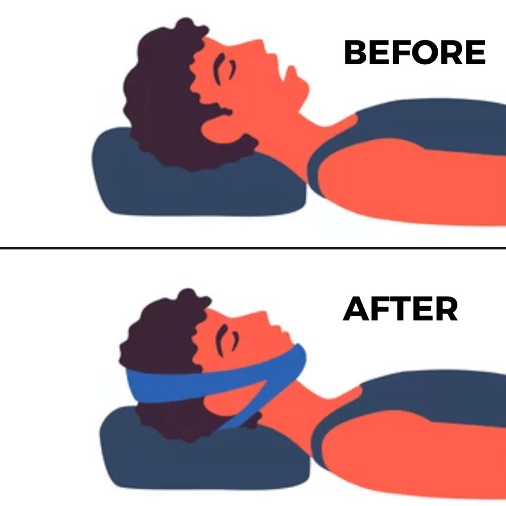 💥Last Day SALE 50% OFF💥AirFlow Jaw Strap